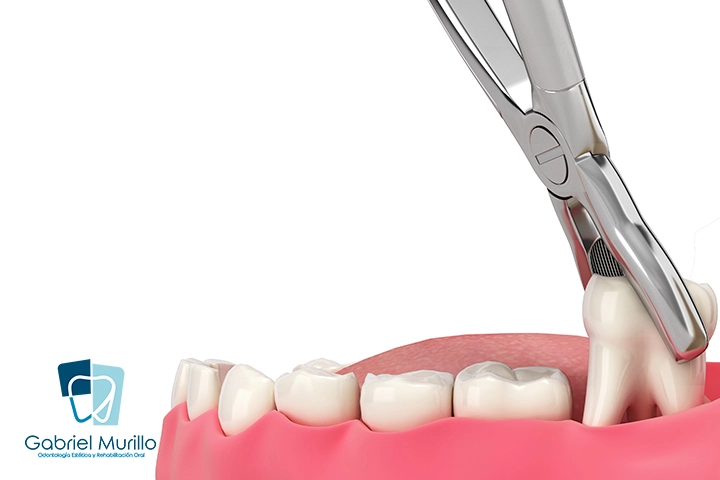 cirugía maxilofacial cirugía maxilofacial